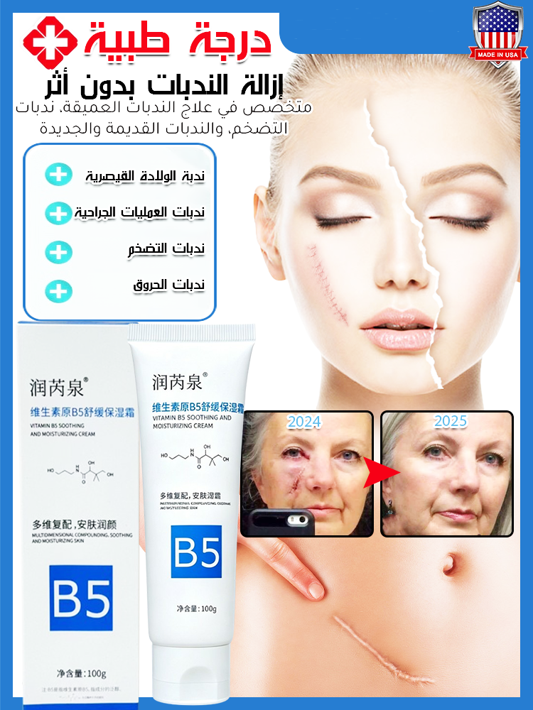 BE503KCF | مرهم السيليكون لإزالة الندوب من ماركة أمريكية-v4