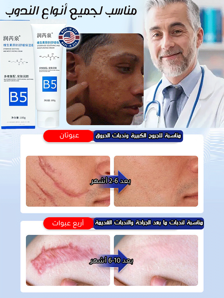 BE503KCF | مرهم السيليكون لإزالة الندوب من ماركة أمريكية-v4