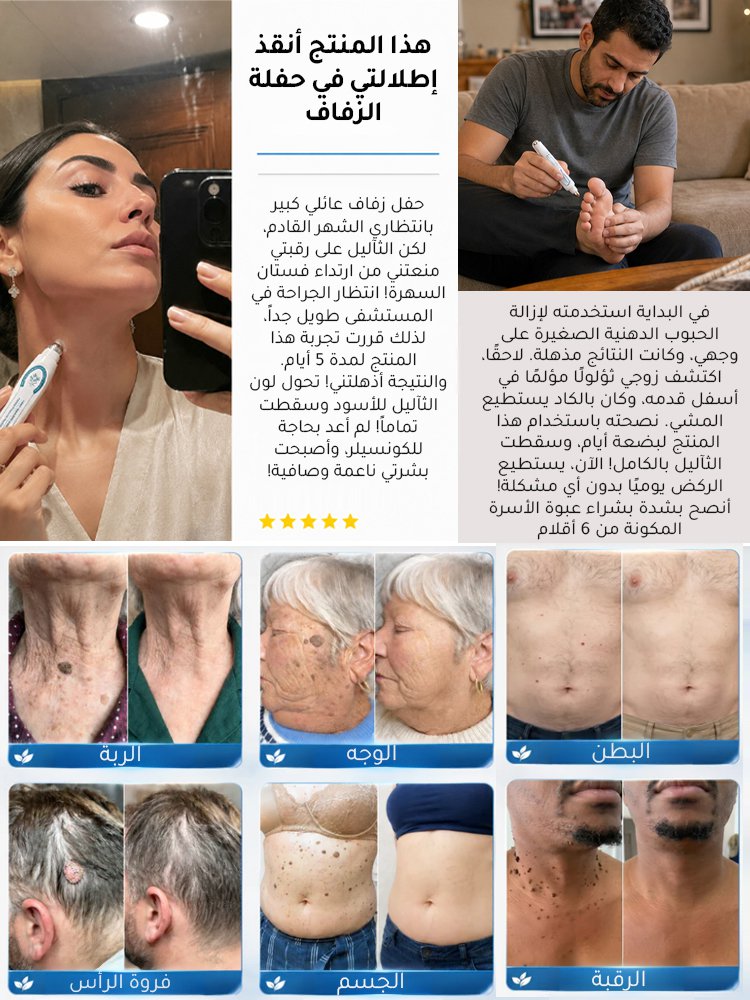 BE3174 | سيروم نباتي لإزالة الثآليل والبقع الداكنة مع أداة وضع كروية دقيقة -v4 BE3174 | سيروم نباتي لإزالة الثآليل والبقع الداكنة مع أداة وضع كروية دقيقة -v4