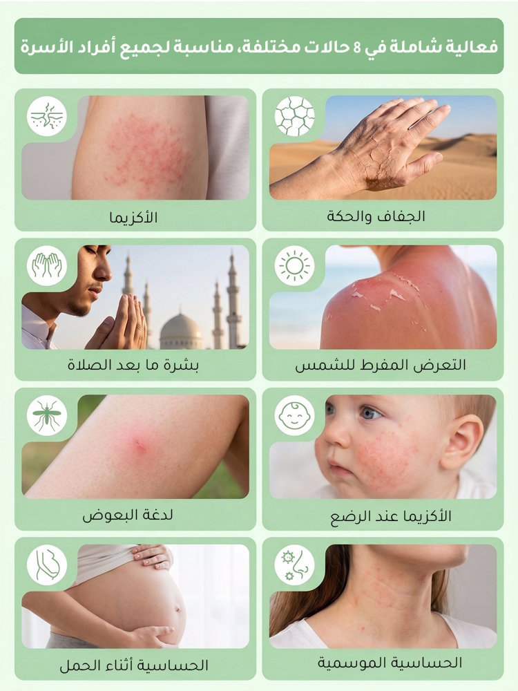 BE3175 | كريم بالأعشاب لترطيب وتهدئة البشرة -v4 BE3175 | كريم بالأعشاب لترطيب وتهدئة البشرة -v4