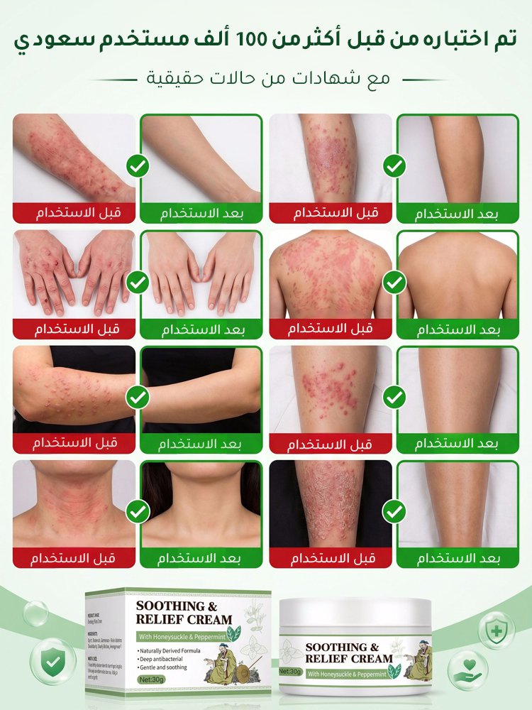 BE3175 | كريم بالأعشاب لترطيب وتهدئة البشرة -v4 BE3175 | كريم بالأعشاب لترطيب وتهدئة البشرة -v4